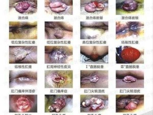 国产菊眼屁股99、为什么国产菊眼屁股 99如此受关注？